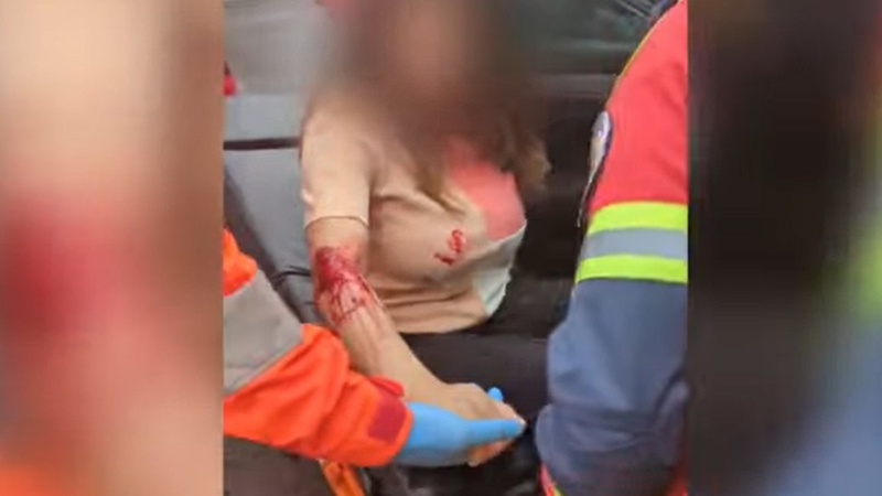 ДТП у Луцьку: легковик збив молоду дівчину