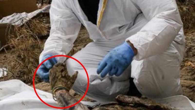 Стало відомо, кому належала рука із синьо-жовтими браслетами з поховання в Ізюмі