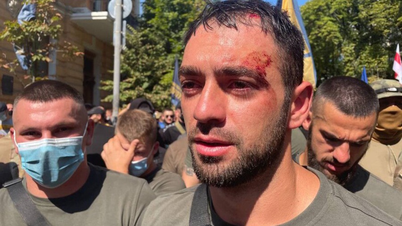 Нацкорпус прийшов до Офісу Президента: відбулися сутички з поліцією