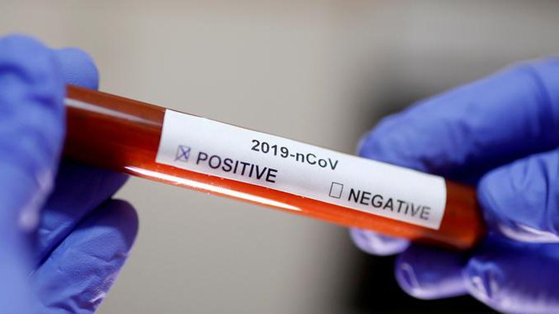 В Україні кількість інфікувань COVID-19 за добу наблизилася до 20 тисяч, померло 433 людини