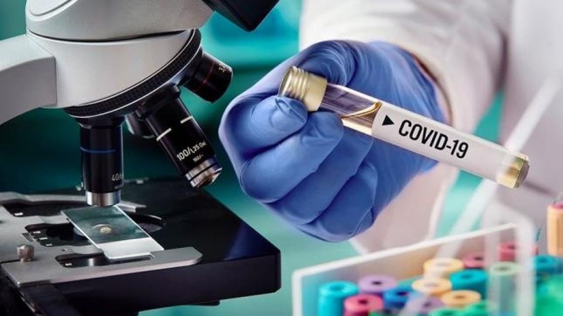 За добу в Україні виявили 852 нові випадки COVID-19