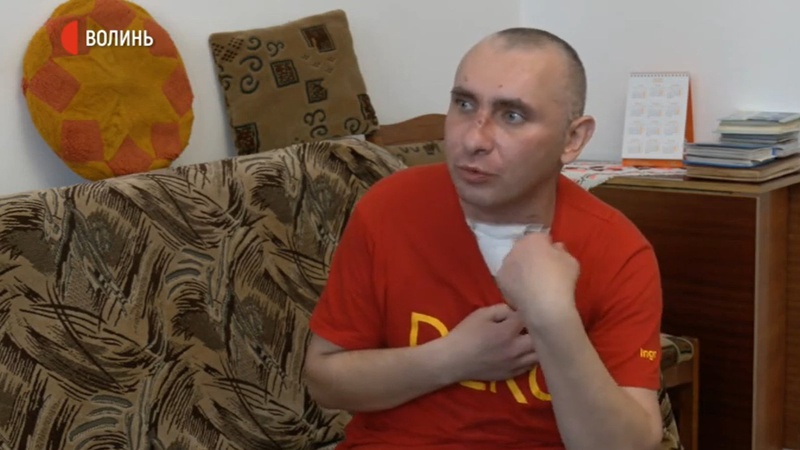 Важкий стан, кома та видужання: волинянин розповів, як здолав COVID-19