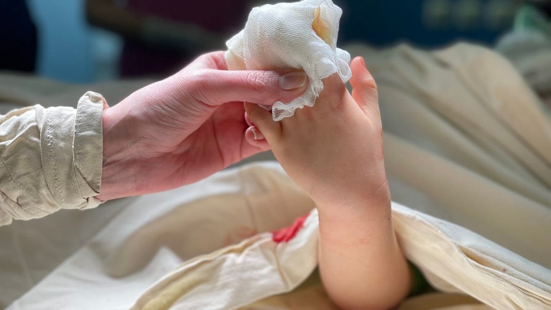 Повідомили про стан постраждалих внаслідок обстрілу на Львівщині