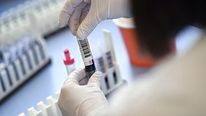 4 випадки коронавірусної інфекції зафіксували на Волині