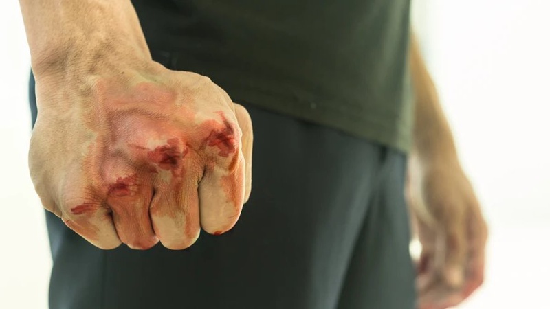 Двом чоловікам, які нанесли тілесні ушкодження службовим особам, повідомили про підозру