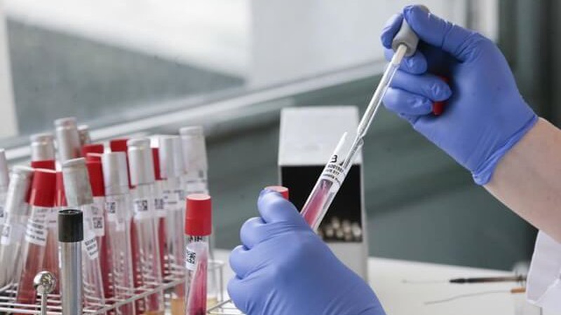 За добу від ускладнень коронавірусу померли двоє волинян