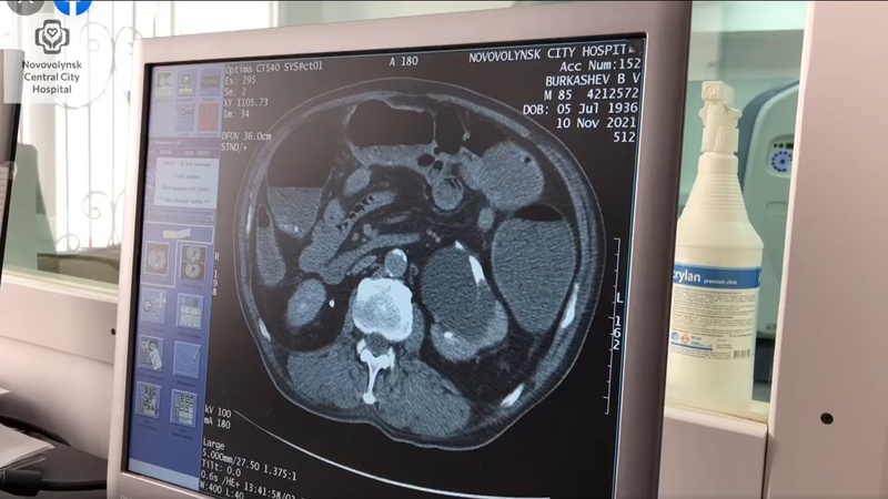 Нововолинська центральна міська лікарня отримала комп’ютерний томограф