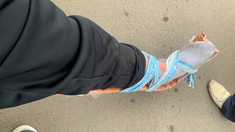 Голова громади на Волині переїхав ногу тероборонівцю і втік. ВІДЕО