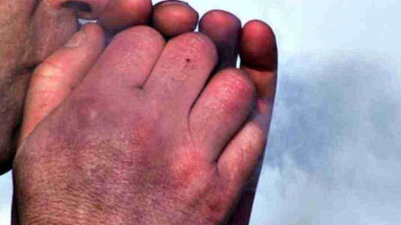 На Волині госпіталізували шістьох людей, які постраждали від переохолодження