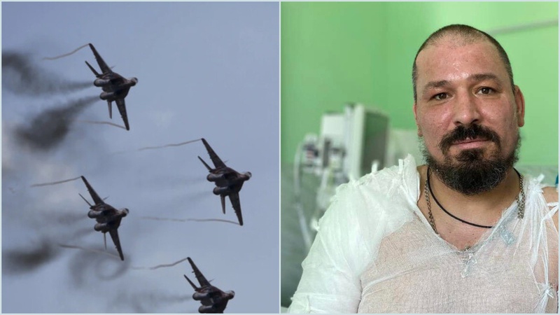 Біль, опіки та множинні переломи: боєць з Волині чудом вижив на полі бою