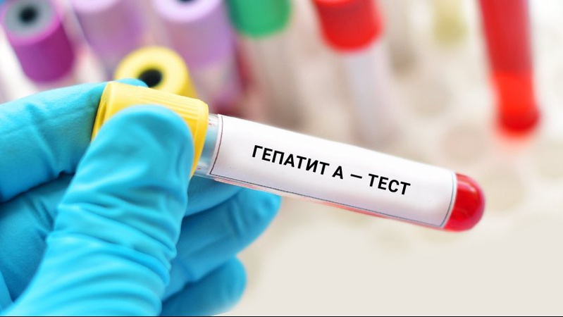 Спалах гепатиту А: в МОЗ дали поради щодо профілактики захворювання