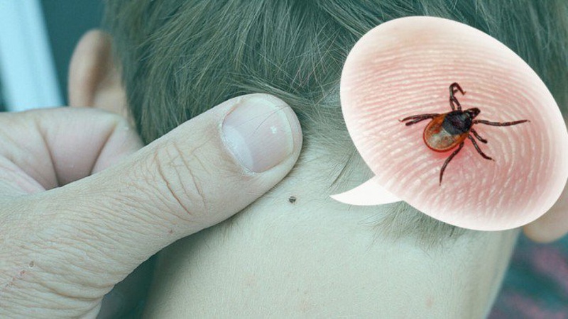 Кліщі атакують: понад пів сотні волинян звернулися цьогоріч до лікарів