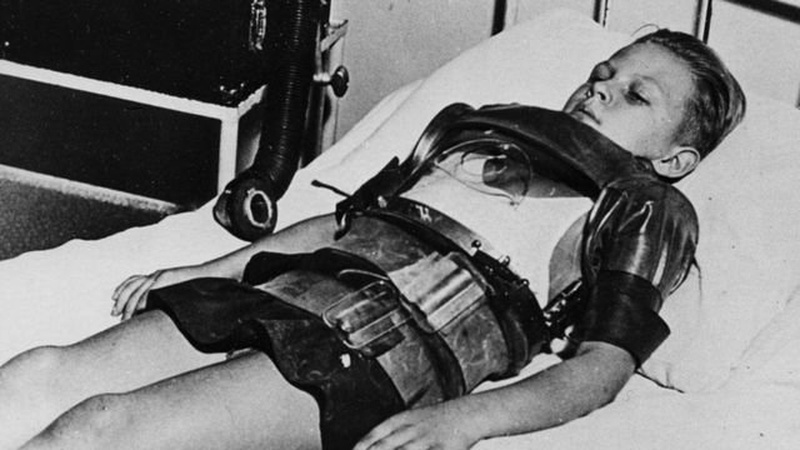 «Жах батьків» – поліомієліт