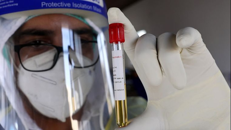 За добу 226 волинян захворіли на коронавірус, одна людина померла