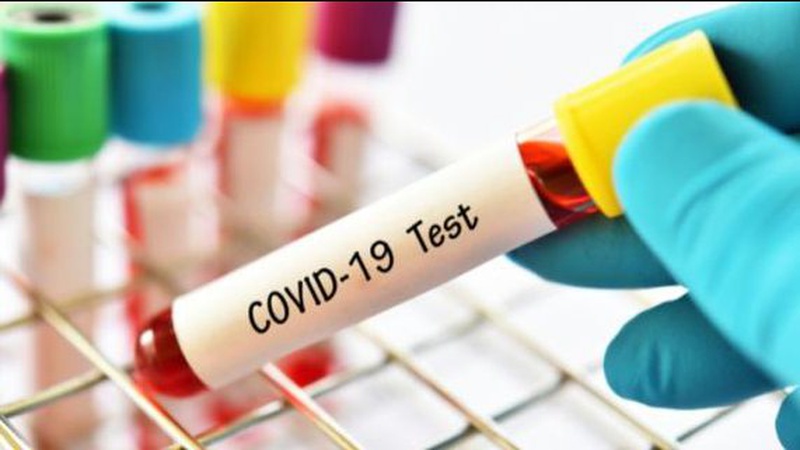 В Україні підтвердили ще 2,6 тисячі COVID-випадків