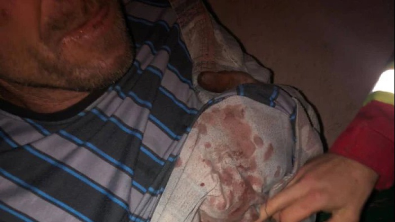 На Волині чоловік порізав ножем знайомого