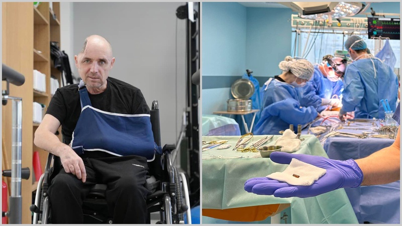 Медики врятували захисника з Волині із уламком снаряду в грудях